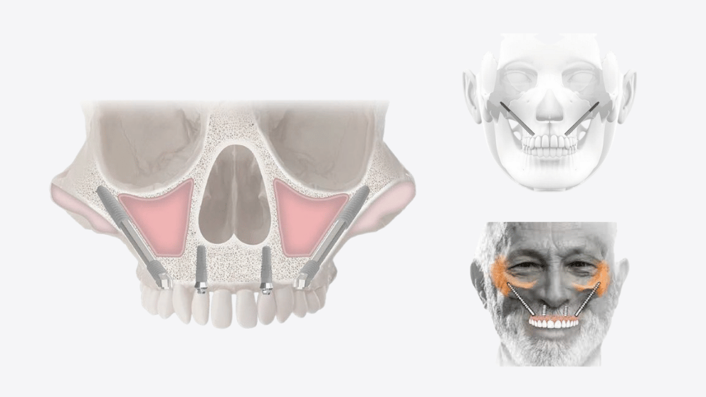 Odontoiatria pediatrica